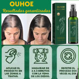 ACEITE CAPILAR PARA EL CRECIMIENTO DEL CABELLO 100 %